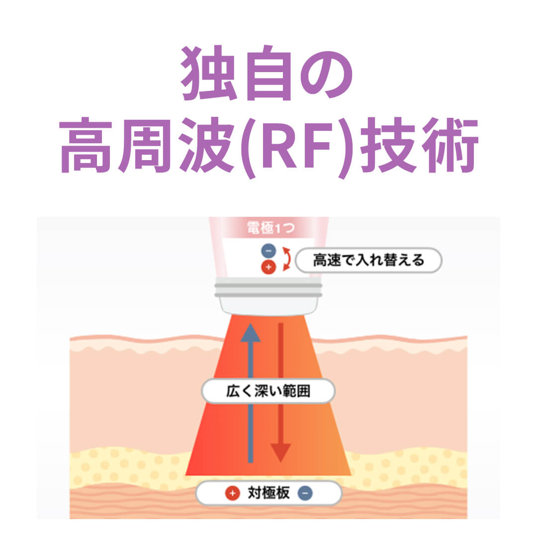 独自の高周波（RF）技術